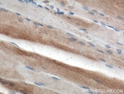 Dystroglycan Rabbit anti-Human, Mouse, Rat, Polyclonal, Proteintech:Antibodies:Primary