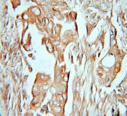 Dystroglycan Rabbit anti-Human, Mouse, Rat, Polyclonal, Proteintech:Antibodies:Primary