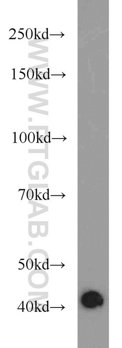 Dystroglycan Rabbit anti-Human, Mouse, Rat, Polyclonal, Proteintech:Antibodies:Primary