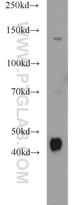 Dystroglycan Rabbit anti-Human, Mouse, Rat, Polyclonal, Proteintech:Antibodies:Primary