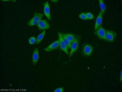 Dystroglycan Rabbit anti-Human, Mouse, Rat, Polyclonal, Proteintech:Antibodies:Primary
