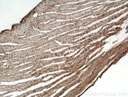 Dystroglycan Rabbit anti-Human, Mouse, Rat, Polyclonal, Proteintech:Antibodies:Primary