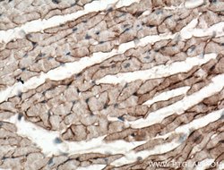 Dystroglycan Rabbit anti-Human, Mouse, Rat, Polyclonal, Proteintech:Antibodies:Primary