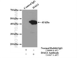 Dystroglycan Rabbit anti-Human, Mouse, Rat, Polyclonal, Proteintech:Antibodies:Primary