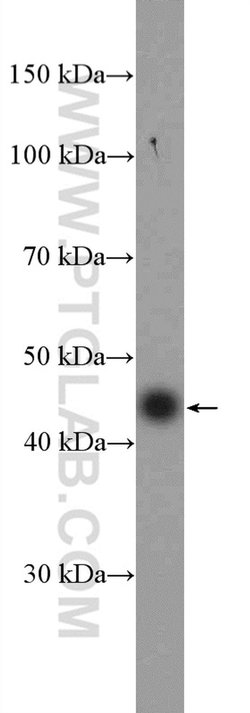 Dystroglycan Rabbit anti-Human, Mouse, Rat, Polyclonal, Proteintech:Antibodies:Primary