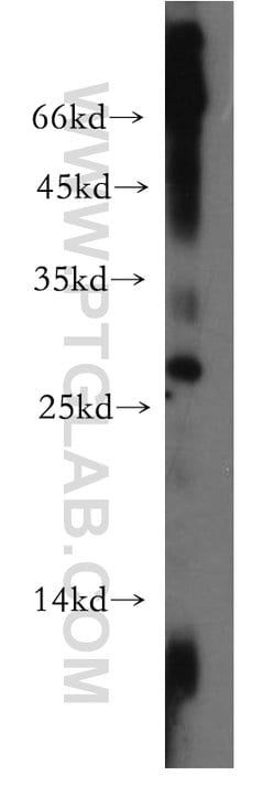 DRAP1 Rabbit anti-Human, Mouse, Rat, Polyclonal, Proteintech:Antibodies:Primary