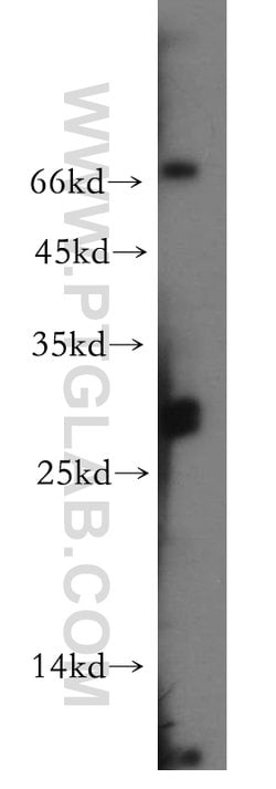 DRAP1 Rabbit anti-Human, Mouse, Rat, Polyclonal, Proteintech:Antibodies:Primary