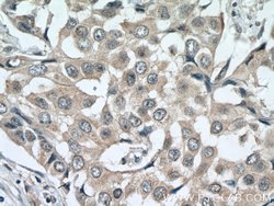 ACTR1B Rabbit anti-Human, Mouse, Rat, Polyclonal, Proteintech:Antibodies:Primary