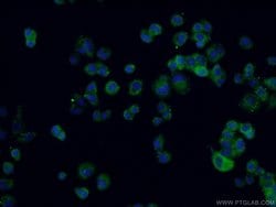 RAB33A Rabbit anti-Human, Mouse, Polyclonal, Proteintech 20 &mu;L | Buy Online | Proteintech | Fisher Scientific