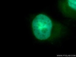 CDK4 Rabbit anti-Human, Mouse, Rat, Polyclonal, Proteintech:Anticuerpos:Anticuerpos