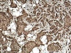 CDK4 Rabbit anti-Human, Mouse, Rat, Polyclonal, Proteintech:Anticuerpos:Anticuerpos