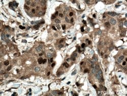 CDK4 Rabbit anti-Human, Mouse, Rat, Polyclonal, Proteintech:Anticuerpos:Anticuerpos