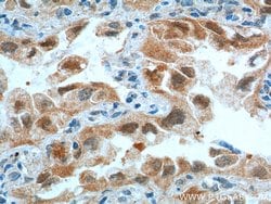 CDK4 Rabbit anti-Human, Mouse, Rat, Polyclonal, Proteintech:Anticuerpos:Anticuerpos