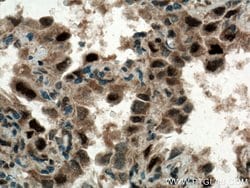 CDK4 Rabbit anti-Human, Mouse, Rat, Polyclonal, Proteintech:Anticuerpos:Anticuerpos