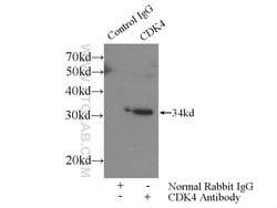 CDK4 Rabbit anti-Human, Mouse, Rat, Polyclonal, Proteintech:Anticuerpos:Anticuerpos
