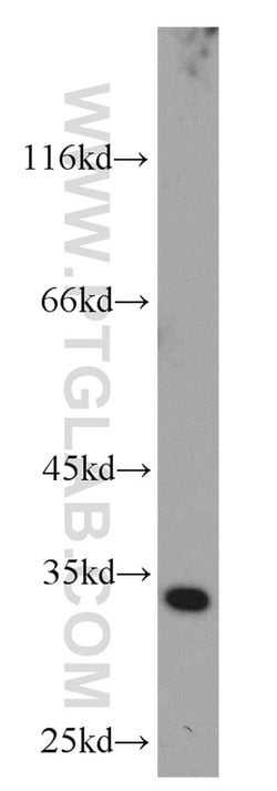 CDK4 Rabbit anti-Human, Mouse, Rat, Polyclonal, Proteintech:Anticuerpos:Anticuerpos