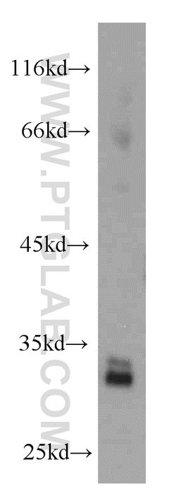 CDK4 Rabbit anti-Human, Mouse, Rat, Polyclonal, Proteintech:Anticuerpos:Anticuerpos
