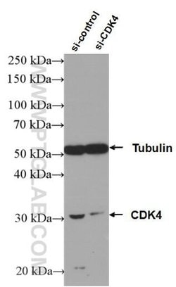 CDK4 Rabbit anti-Human, Mouse, Rat, Polyclonal, Proteintech:Anticuerpos:Anticuerpos
