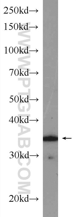CDK4 Rabbit anti-Human, Mouse, Rat, Polyclonal, Proteintech:Anticuerpos:Anticuerpos