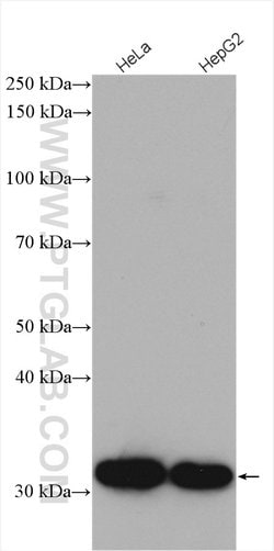 CDK4 Rabbit anti-Human, Mouse, Rat, Polyclonal, Proteintech:Anticuerpos:Anticuerpos