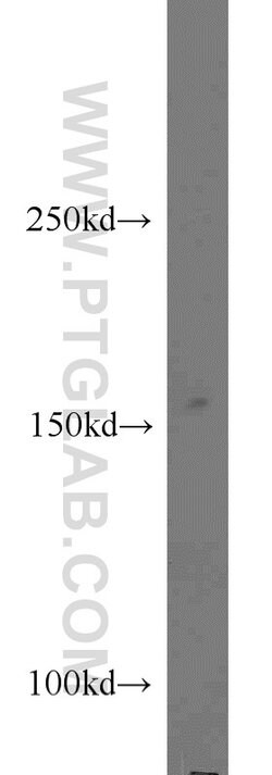 CPSF1 Rabbit anti-Human, Mouse, Rat, Polyclonal, Proteintech 150 &mu;L;