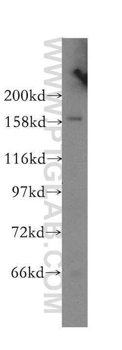 CPSF1 Rabbit anti-Human, Mouse, Rat, Polyclonal, Proteintech 150 &mu;L;