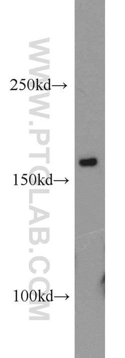 CPSF1 Rabbit anti-Human, Mouse, Rat, Polyclonal, Proteintech 150 &mu;L;