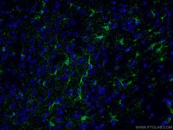 Glutamine synthetase Rabbit anti-Human, Mouse, Rat, Polyclonal, Proteintech:Antibodies:Primary