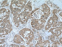 Glutamine synthetase Rabbit anti-Human, Mouse, Rat, Polyclonal, Proteintech:Antibodies:Primary