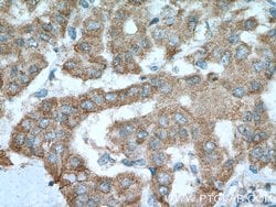 Glutamine synthetase Rabbit anti-Human, Mouse, Rat, Polyclonal, Proteintech:Antibodies:Primary