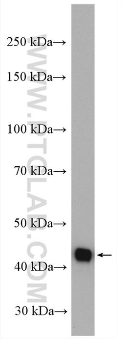 Glutamine synthetase Rabbit anti-Human, Mouse, Rat, Polyclonal, Proteintech:Antibodies:Primary