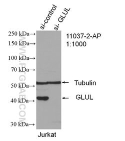 Glutamine synthetase Rabbit anti-Human, Mouse, Rat, Polyclonal, Proteintech:Antibodies:Primary