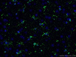 Glutamine synthetase Rabbit anti-Human, Mouse, Rat, Polyclonal, Proteintech:Antibodies:Primary
