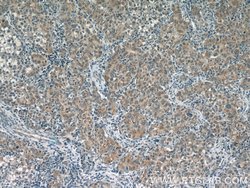 Glutamine synthetase Rabbit anti-Human, Mouse, Rat, Polyclonal, Proteintech:Antibodies:Primary