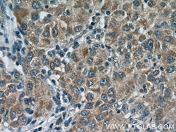 Glutamine synthetase Rabbit anti-Human, Mouse, Rat, Polyclonal, Proteintech:Antibodies:Primary