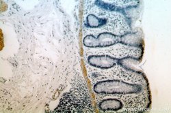 TPM2 Rabbit anti-Human, Mouse, Rat, Polyclonal, Proteintech 150 &mu;L;