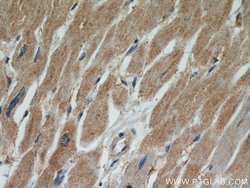 TPM2 Rabbit anti-Human, Mouse, Rat, Polyclonal, Proteintech 150 &mu;L;