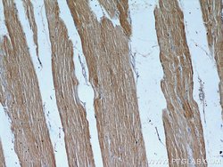 TPM2 Rabbit anti-Human, Mouse, Rat, Polyclonal, Proteintech 150 &mu;L;
