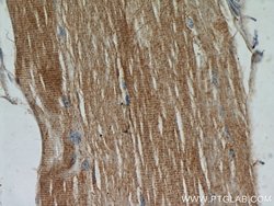 TPM2 Rabbit anti-Human, Mouse, Rat, Polyclonal, Proteintech 150 &mu;L;
