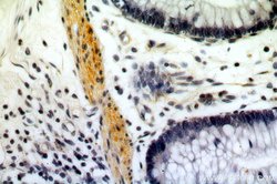 TPM2 Rabbit anti-Human, Mouse, Rat, Polyclonal, Proteintech 150 &mu;L;