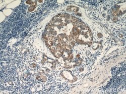 TPM2 Rabbit anti-Human, Mouse, Rat, Polyclonal, Proteintech 150 &mu;L;