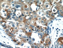 TPM2 Rabbit anti-Human, Mouse, Rat, Polyclonal, Proteintech 150 &mu;L;