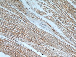 TPM2 Rabbit anti-Human, Mouse, Rat, Polyclonal, Proteintech 150 &mu;L;