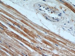 TPM2 Rabbit anti-Human, Mouse, Rat, Polyclonal, Proteintech 150 &mu;L;