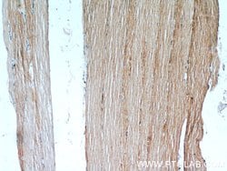 TPM2 Rabbit anti-Human, Mouse, Rat, Polyclonal, Proteintech 150 &mu;L;