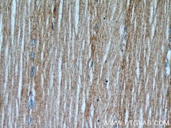TPM2 Rabbit anti-Human, Mouse, Rat, Polyclonal, Proteintech 150 &mu;L;