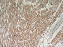 TPM2 Rabbit anti-Human, Mouse, Rat, Polyclonal, Proteintech 150 &mu;L;