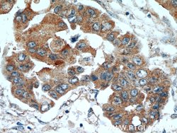 TPM2 Rabbit anti-Human, Mouse, Rat, Polyclonal, Proteintech 150 &mu;L;