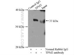 TPM2 Rabbit anti-Human, Mouse, Rat, Polyclonal, Proteintech 150 &mu;L;