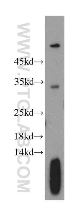 TPM2 Rabbit anti-Human, Mouse, Rat, Polyclonal, Proteintech 150 &mu;L;
